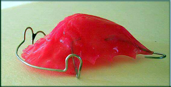 Hawley Retainer