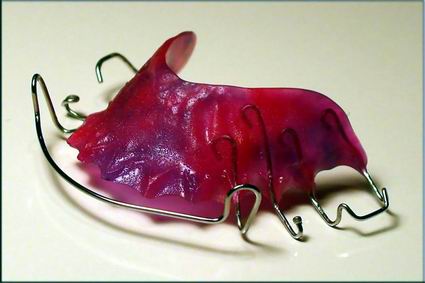 Hawley Retainer