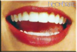 Perfect Smile